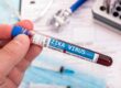 Zika Virus
