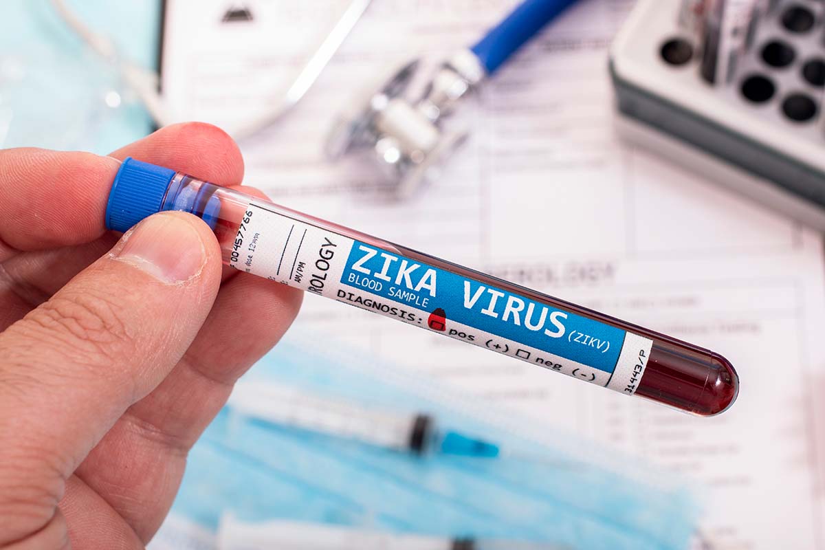 Zika Virus
