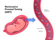Non-Invasive Prenatal Test (NIPT)