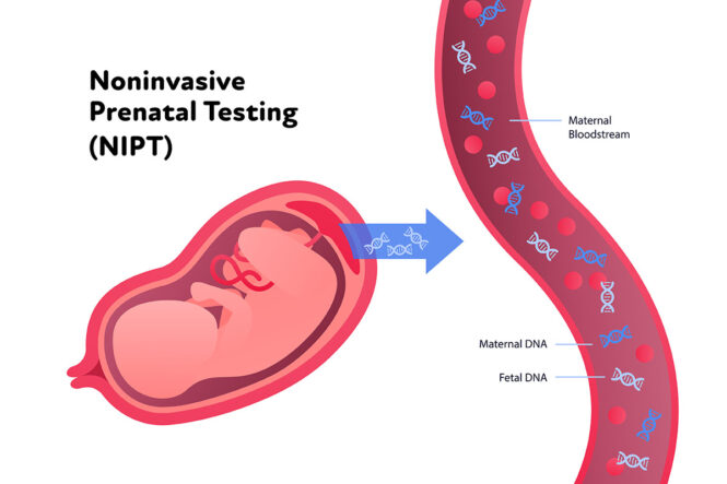 Non-Invasive Prenatal Test (NIPT) Non-Invasive Prenatal Test (NIPT)